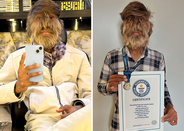 Man with extreme hair growth on face and body holding phone and Guinness World Records certificate for hairiest face.
