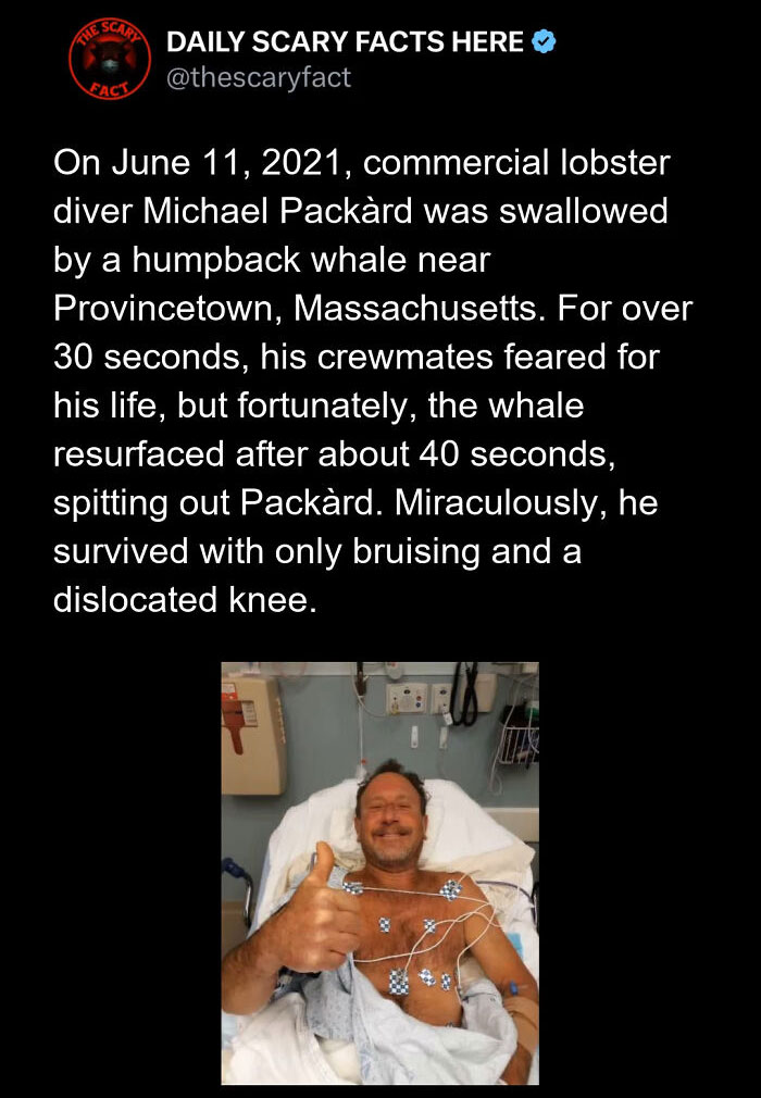 Man in hospital bed giving thumbs up after surviving whale attack, featured in daily scary facts about shocking encounters.