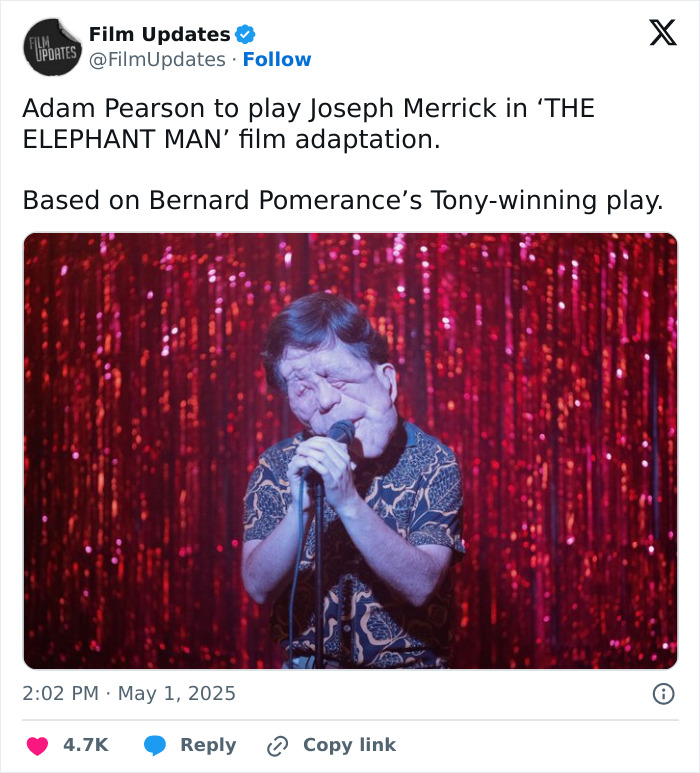 Adam Pearson no palco interpretando Joseph Merrick em uma adaptação cinematográfica, destacando os fãs gritando tweets ofensivos.