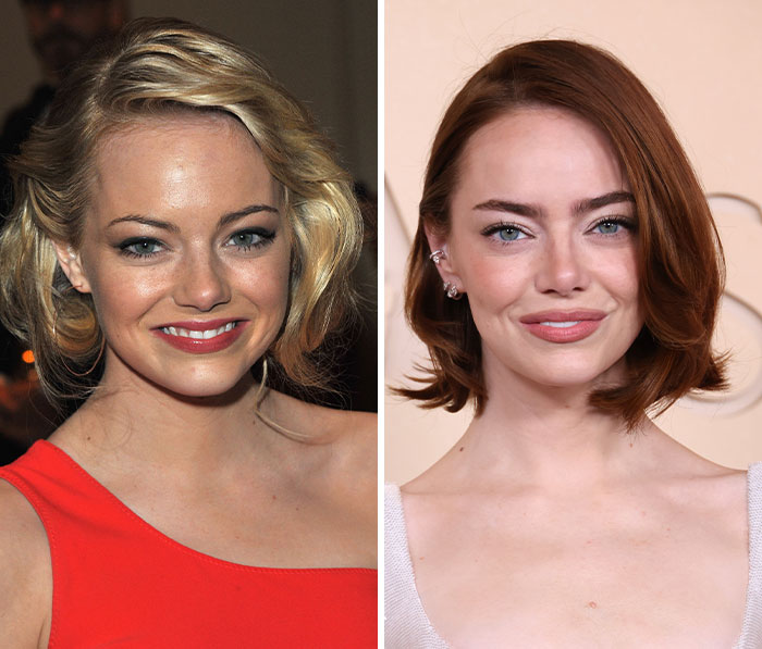 Side-by-side images showing Oscars red carpet with visible plastic surgery and weight loss effects on two female celebrities.