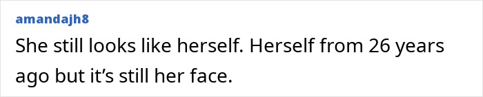 Denise Richards revela transformação dramática do facelift em fotos de antes e depois