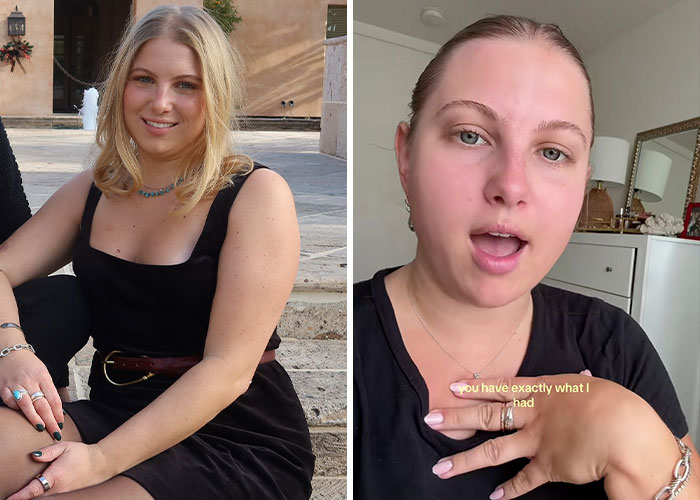Side-by-side images of a young woman, one outdoors smiling in a black dress, the other indoors explaining a bizarre medical problem.