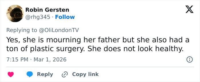 Tweet criticizing Kelly Osbourne’s health and plastic surgery in response to Brit Awards look going viral.