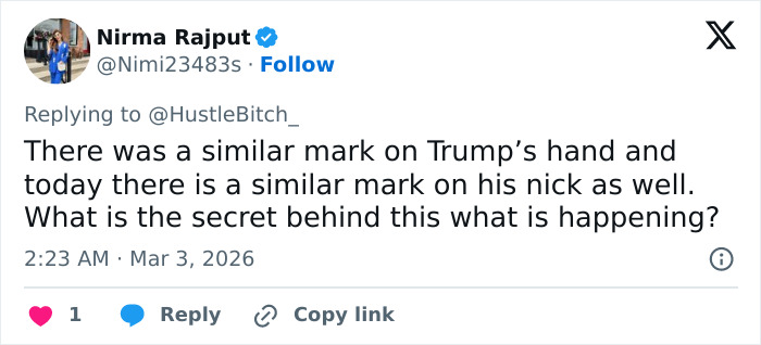 Screenshot of a tweet discussing a mark on Trump&rsquo;s neck, relating to doctors&rsquo; opinions on his neck rash causes.