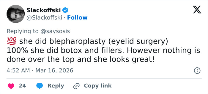 A aparição de Anne Hathaway no Oscar provoca reações selvagens enquanto os fãs percebem algo estranho