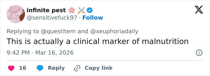 Screenshot of a social media post discussing a disturbing detail noticed in photos of Maude Apatow at Oscars party.