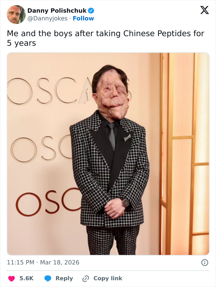 Homem com terno estampado em um evento, relacionado a Adam Pearson se juntando aos fãs para divulgar o tweet ofensivo do comediante.