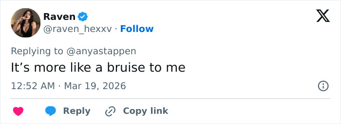 Tweet from Raven replying to Anya Taylor-Joy, discussing a bruise spotted in Anya Taylor-Joy’s latest interview appearance.