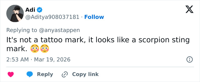 User comment on Anya Taylor-Joy’s latest interview appearance, sparking debate about a scorpion sting mark.