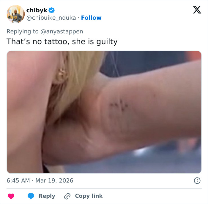 Close-up of Anya Taylor-Joy’s arm showing an odd detail spotted by fans during her latest interview appearance.