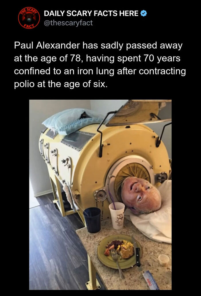 Paul Alexander in an iron lung after contracting polio, illustrating a scary fact about long-term medical confinement.