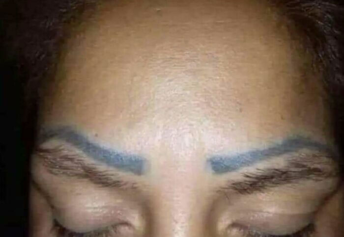 Close-up of a forehead with failed blue tattoo ink on eyebrows illustrating ink fails and bad idea regrets.