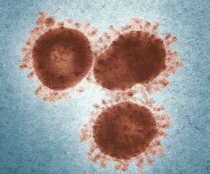 37 Doctors Share Which Diseases Should Scare People More Than They Do