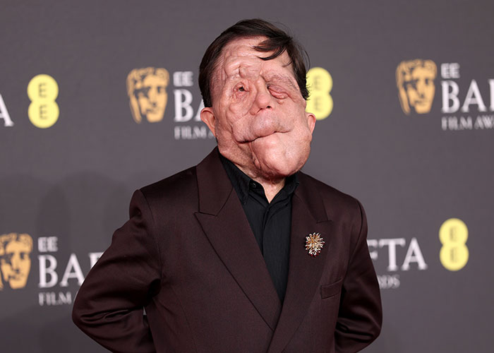 Adam Pearson participando do BAFTA Film Awards, vestindo terno escuro e broche, destacando Adam Pearson e polêmica ofensiva no tweet.