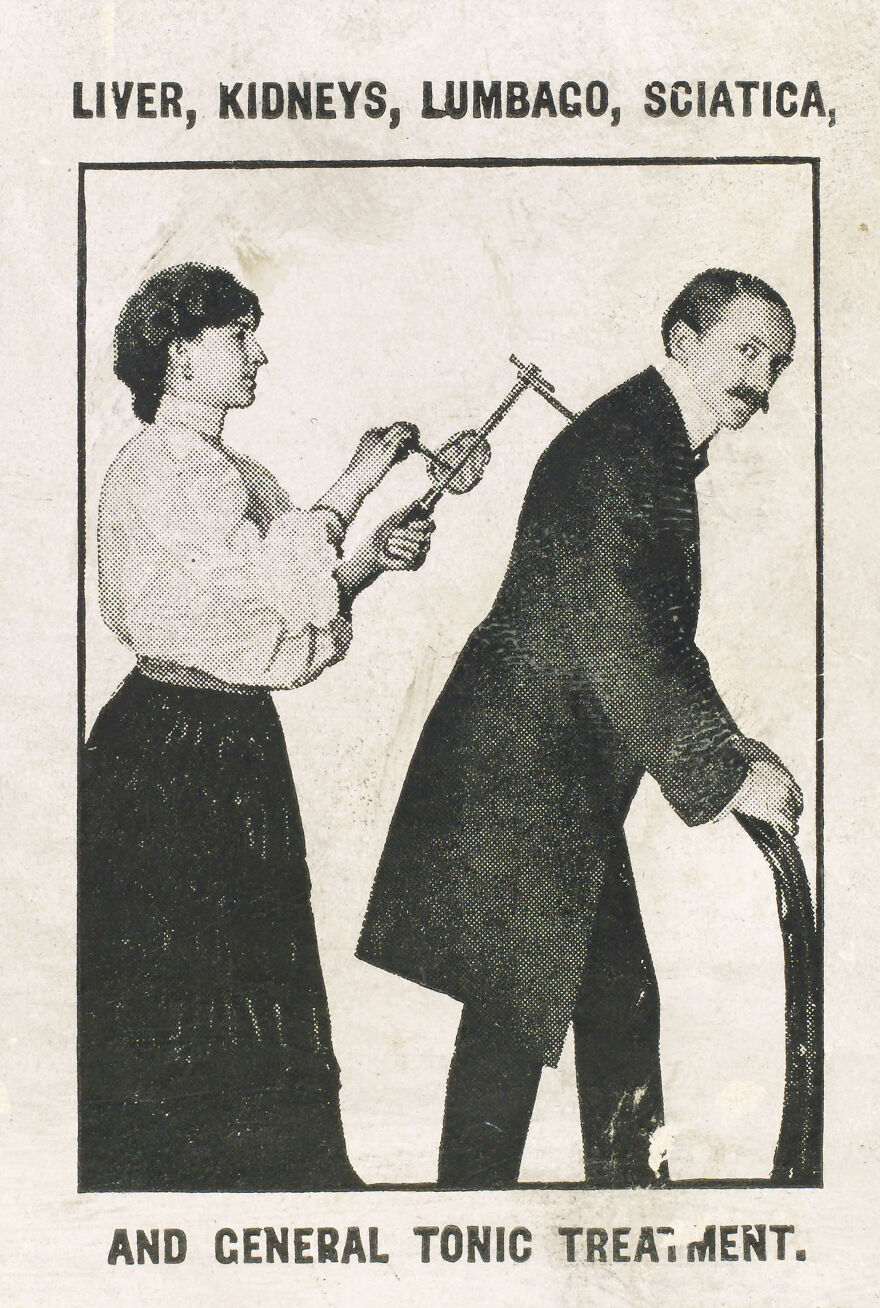 Vintage medical illustration showing curious objects used for treating ailments like lumbago and sciatica.