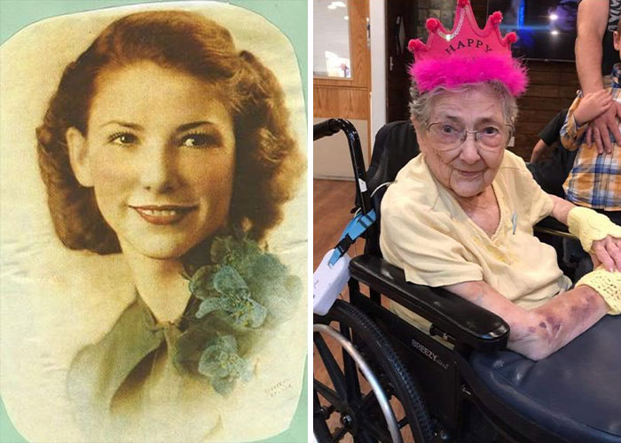 Side-by-side photos showing a woman in youth and old age, illustrating bizarre medical problems and mysteries.
