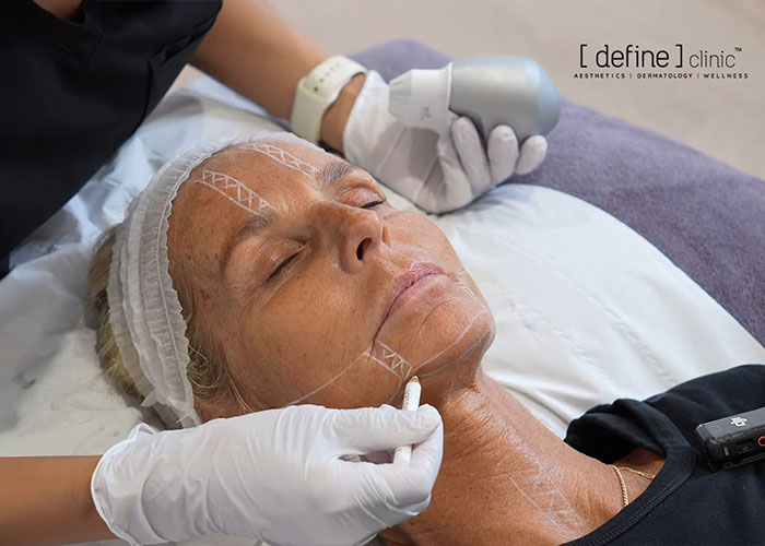 Ulrika Jonsson, 58, revela os seis meses de tratamento por trás de sua transformação dramática Ulrika Jonsson, 58, revela os seis meses de tratamento por trás de sua transformação dramática