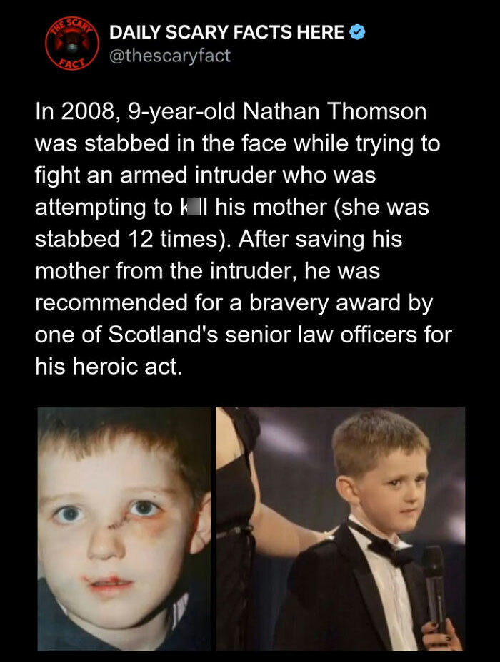 Young boy shows facial injuries and later appears in a tuxedo, representing a brave act in a scary fact story.