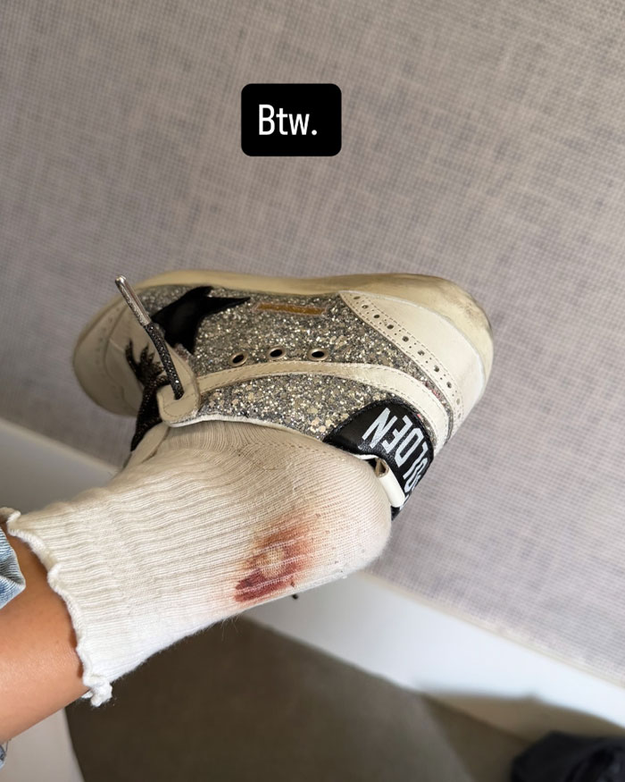 JoJo Siwa revela consequências dolorosas do casamento depois de caminhar até o altar com Chris Hughes JoJo Siwa revela consequências dolorosas do casamento depois de caminhar até o altar com Chris Hughes