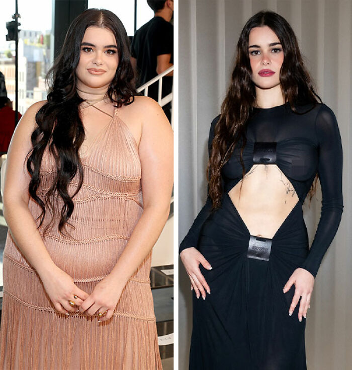 Barbie Ferreira pictured before and after her dramatic transformation sparking a heated debate on her changing appearance.