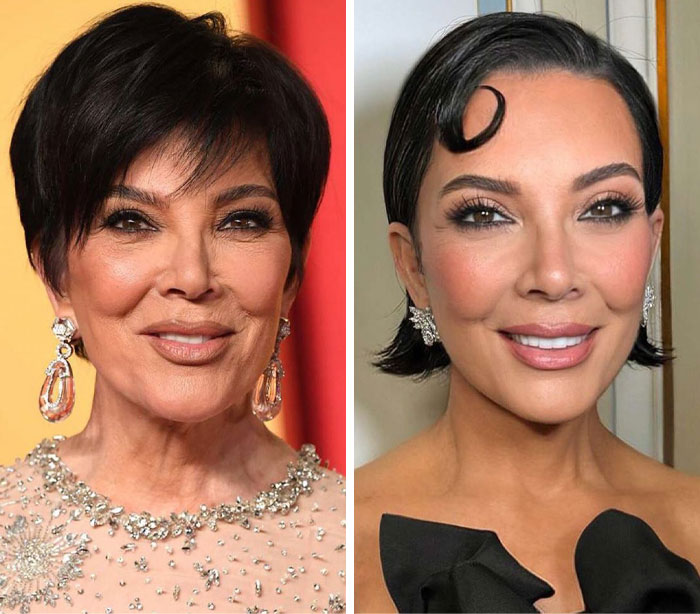 Before-and-after cosmetic procedure photos of a woman showing visible changes after surgery and people&rsquo;s reactions online.