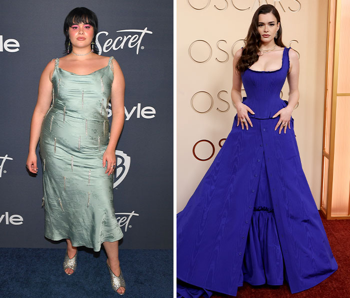 Two women on the Oscars red carpet showcasing plastic surgery and weight loss side effects in elegant gowns.