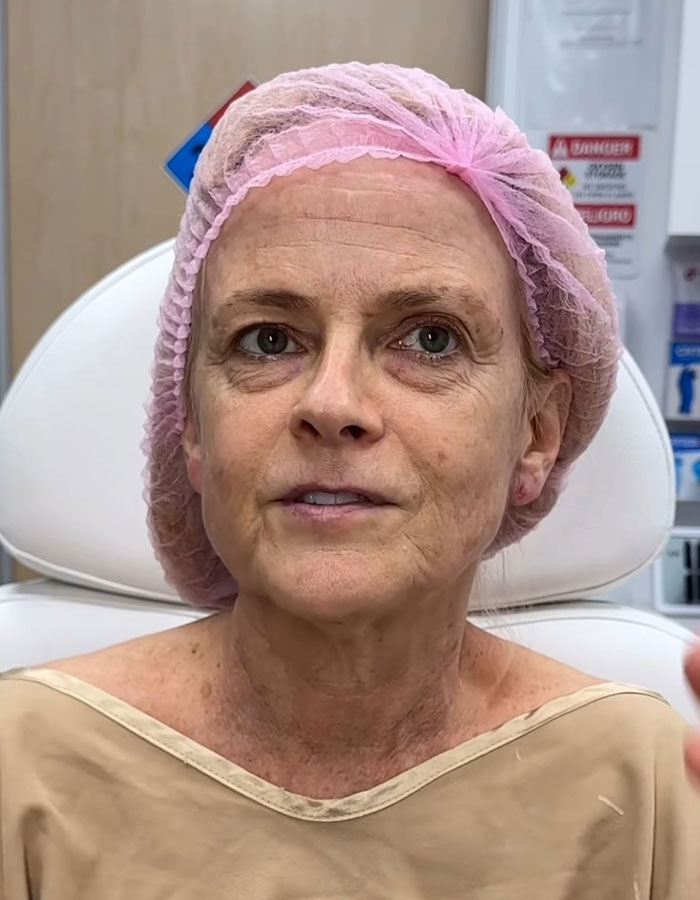 Grandma wearing a pink surgical cap and beige gown sitting in clinic chair before plastic surgeon transformation.