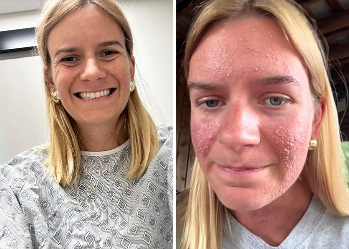 Side-by-side images of a woman smiling and showing bizarre medical skin condition highlighting unusual medical problems and mysteries.