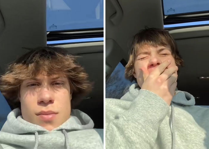 Young man with messy uneven hair shows shocked reaction, illustrating people traumatized by hairdressers' bad haircuts.