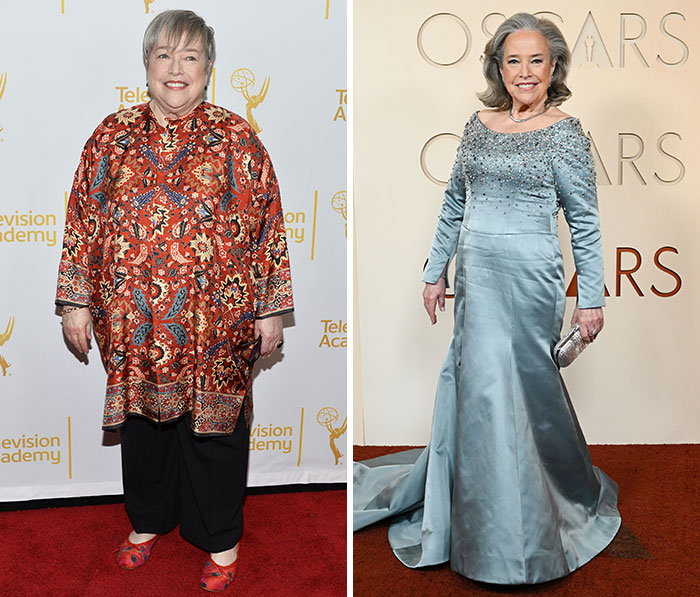 Two women on the Oscars red carpet showcasing plastic surgery and weight loss side effects in elegant attire.