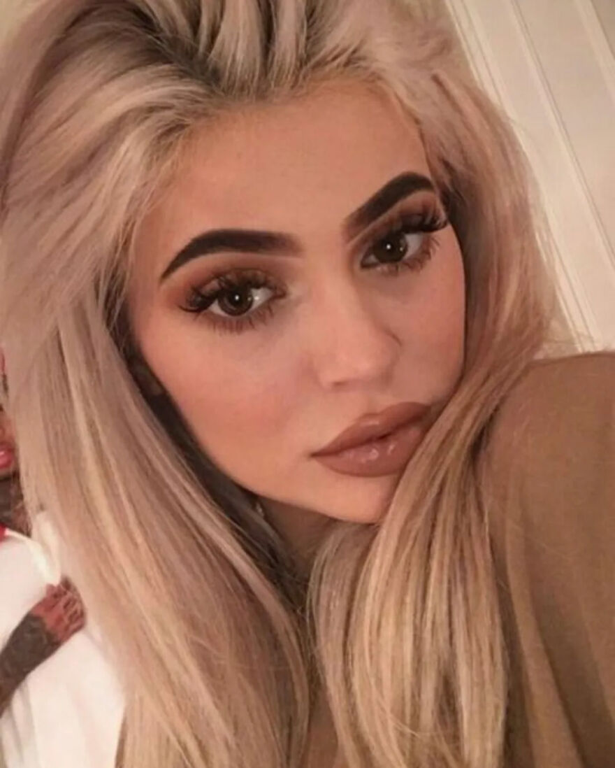 Close-up of Kylie Jenner with blonde hair and makeup highlighting changes from procedures on her face.