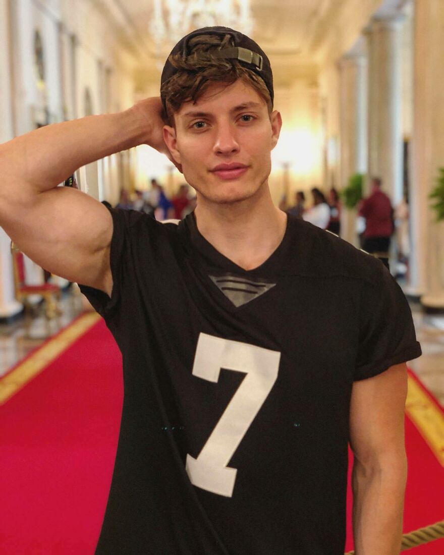 Matt Rife posing casually in a black shirt and cap, addressing plastic surgery rumors in his new book. Matt Rife posing casually in a black shirt and cap, addressing plastic surgery rumors in his new book.