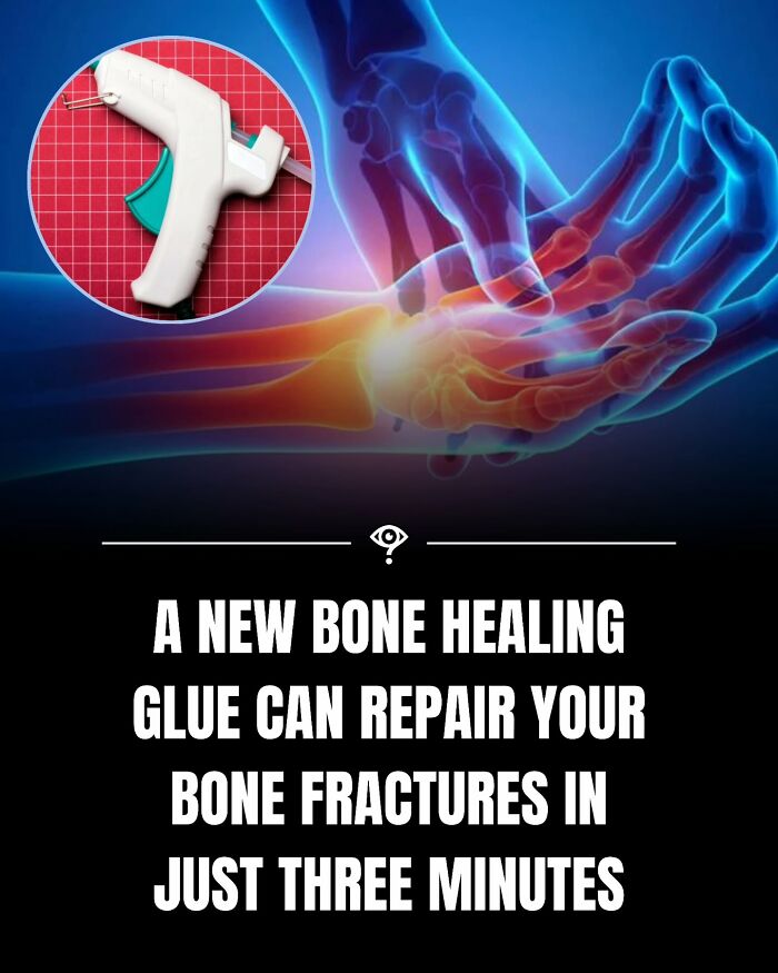 Bone healing technology shown with glue gun and X-ray hands, highlighting fast bone fracture repair in minutes.