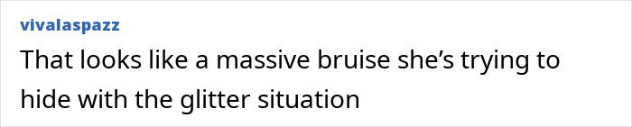 Gwyneth Paltrow backstage at the Oscars showing frustration after a racy dress mishap with aide’s awkward reaction nearby