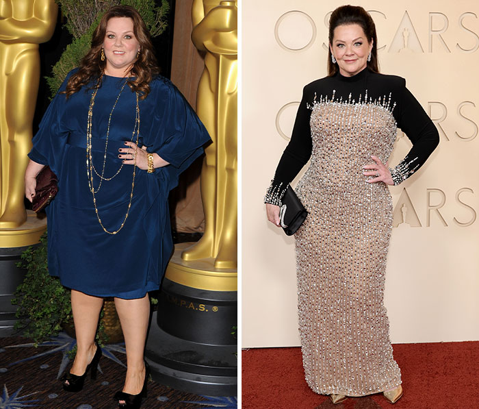 Actress on Oscars red carpet showcasing plastic surgery and weight loss side effects in elegant blue and beaded dresses.