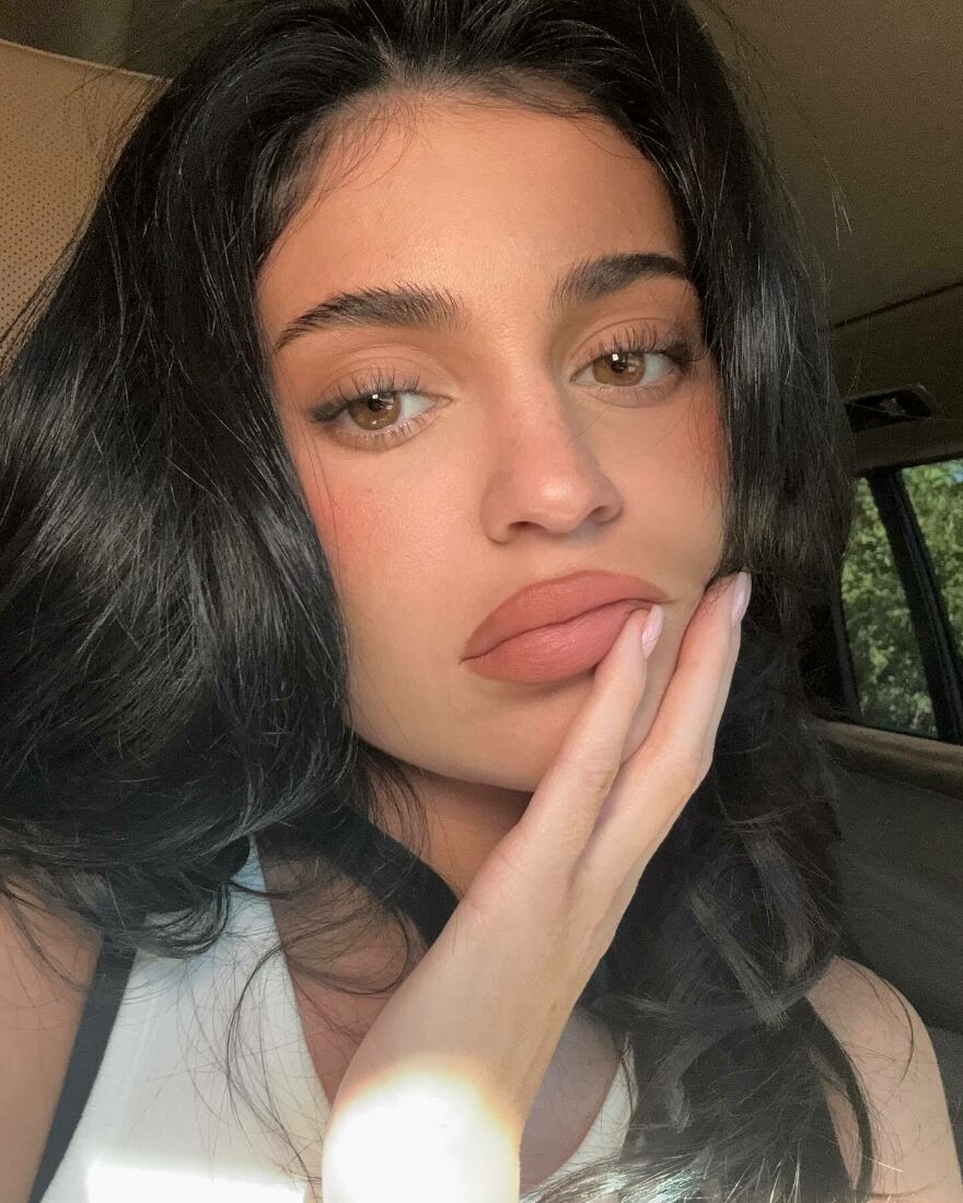 Close-up of Kylie Jenner with natural makeup showcasing her facial features after the procedures in soft natural light.
