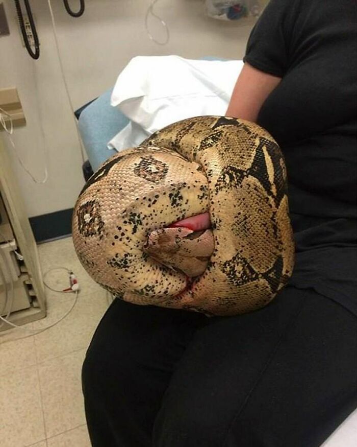 Large snake tightly coiled around a person's arm in a clinical setting, an unusual medical photo blending science and nightmare.