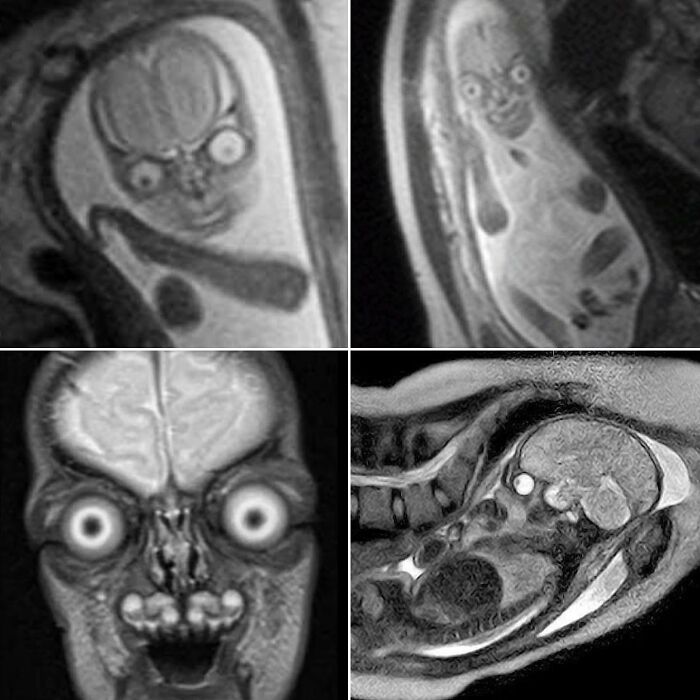 MRI scans showing unusual medical images with eerie, distorted features that blur the line between science and nightmare.