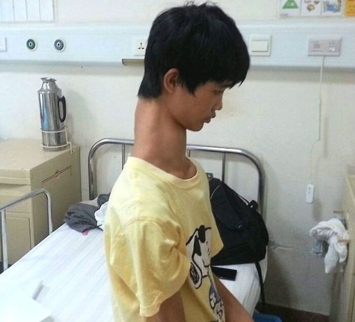 Young person in a yellow shirt sitting on a hospital bed, in a clinical room with medical equipment nearby.