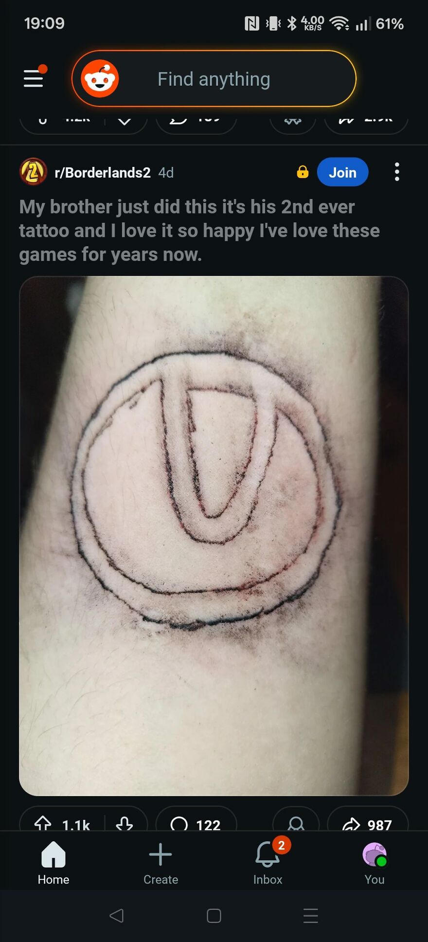 Close-up of a questionable tattoo showing a rough, circular design on pale skin, highlighting unusual tattoo artistry.