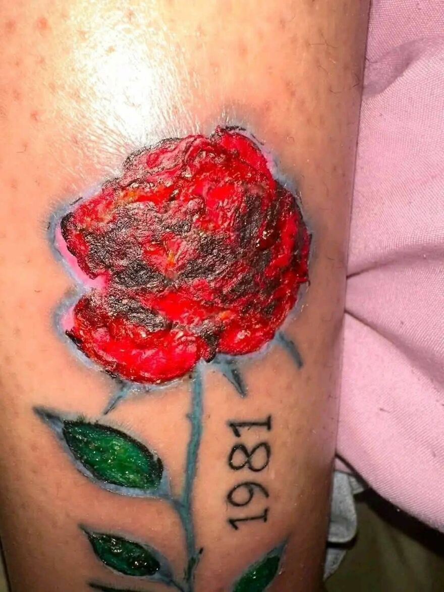 Tattoo of a red rose with the year 1981 inked below, showing unusual texture and color quality on the skin.