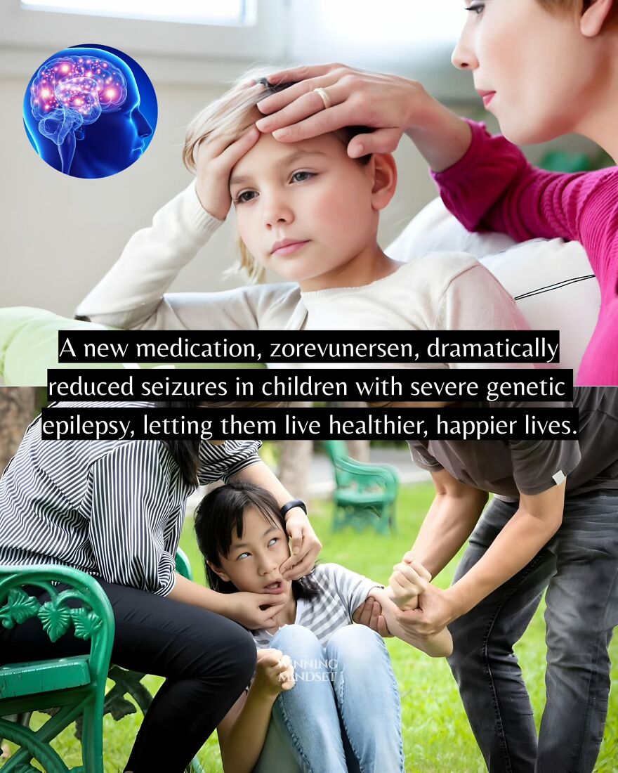 Child receiving care for severe genetic epilepsy with new medication reducing seizures for healthier lives.