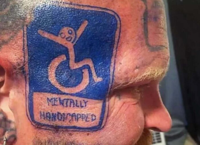 Tattoo fail showing a blue ink handicap symbol with text humorously misspelling mentally handicapped on a man's face.