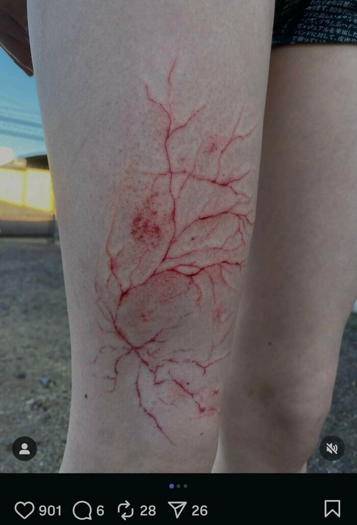 Tattoo resembling red scratches on leg skin