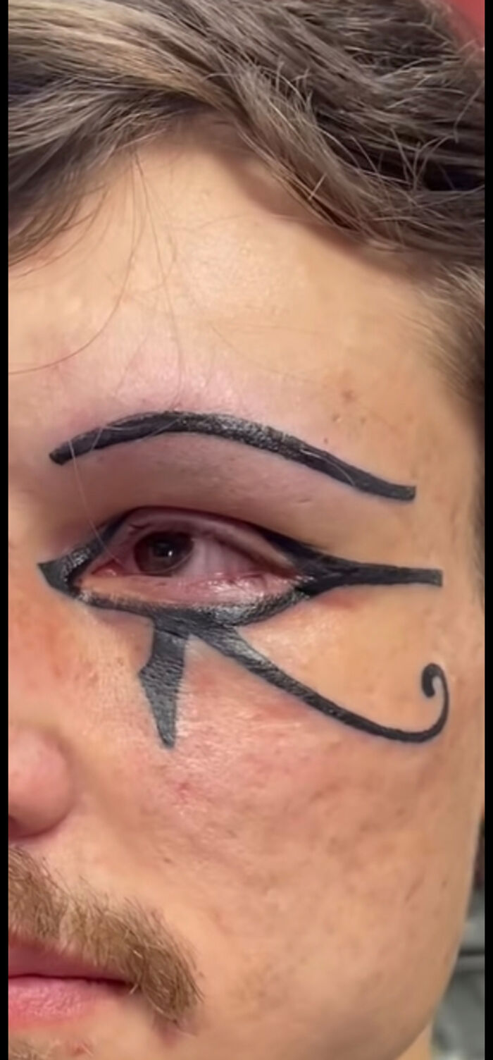 Tattoo fails with uneven black eyeliner style tattoo around eye