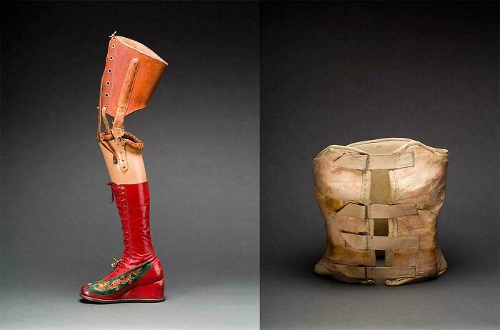 Antique prosthetic leg and an old medical corset from historical era discovery