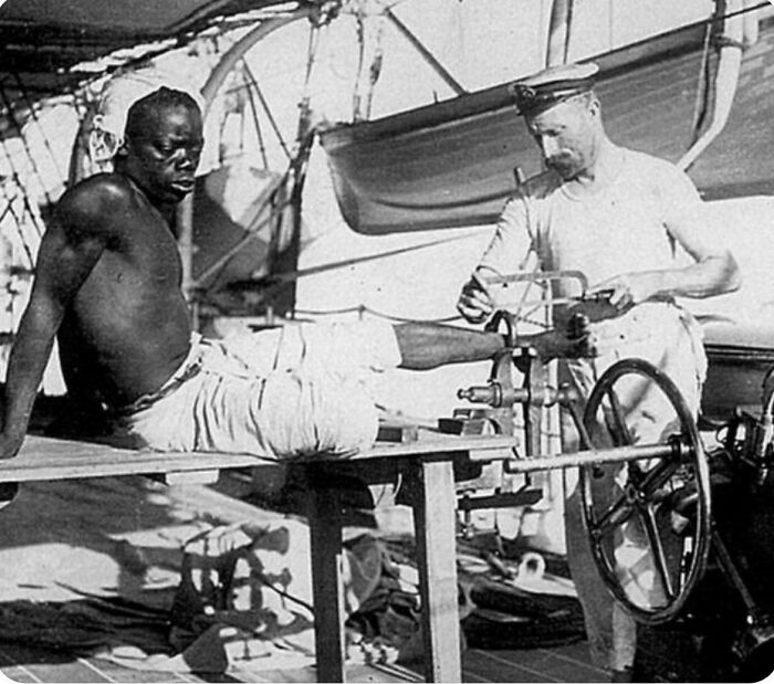 A man with a prosthetic leg being fitted by a medical professional, one of the emotional historical photos.