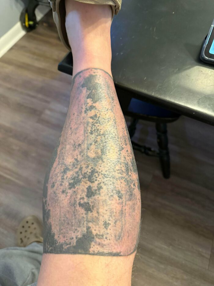 Coming Up On 1 Year Since My Nightmare Blackout Tattoo
