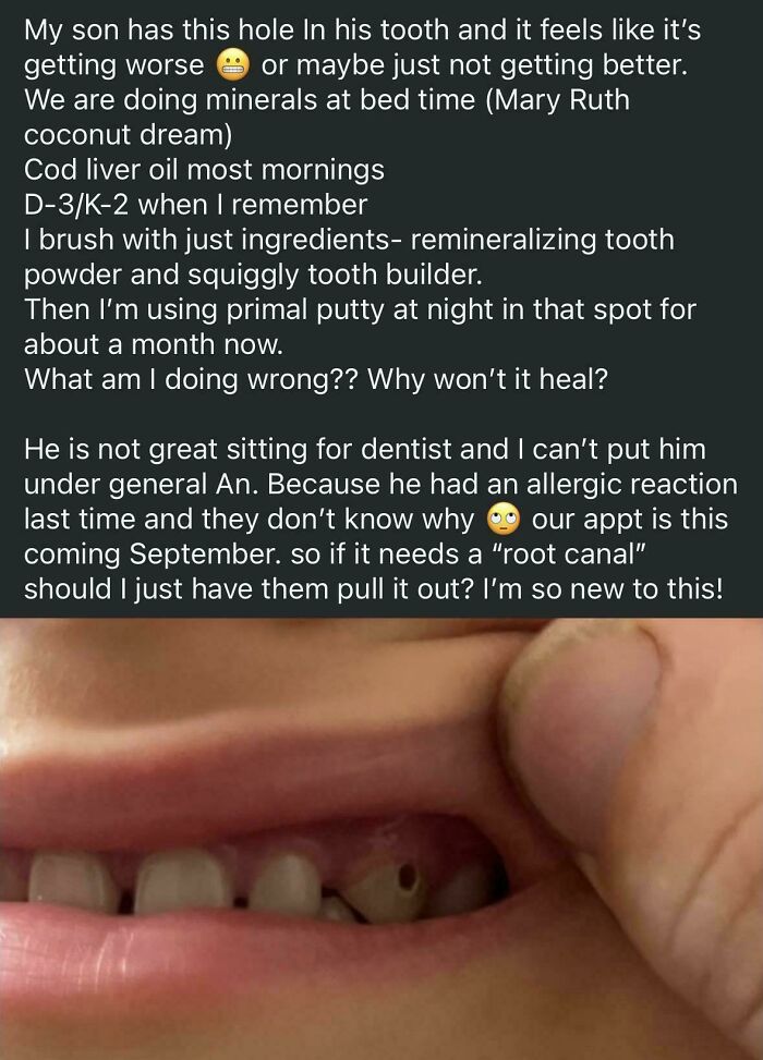A social media post from an unhinged mom asking for advice on her son's tooth decay.