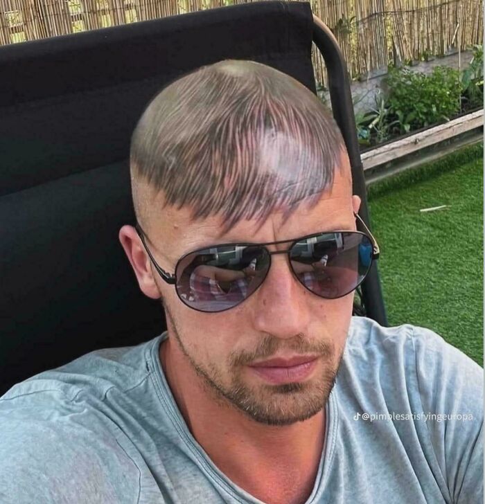 A man wearing sunglasses with a tattoo on his head that resembles a bad haircut with bangs.